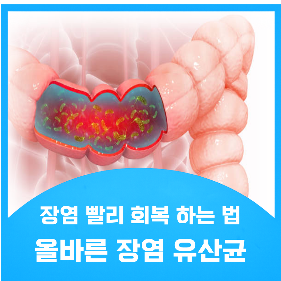 장염 유산균